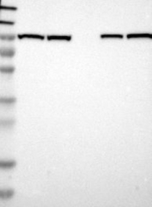 NBP1-81620 - TER ATPase / VCP